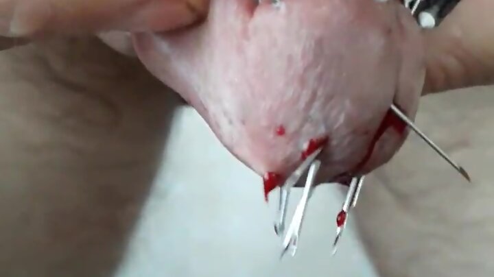Once again playing with needles